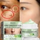 thumbnail image 2 of Crema blanqueadora efectiva para pecas, elimina el Melasma, manchas oscuras, aclara el acné, melanina, ilumina, hidratante, antienvejecimiento, cuidado de la piel facial Fivean unisex, 2 of 2