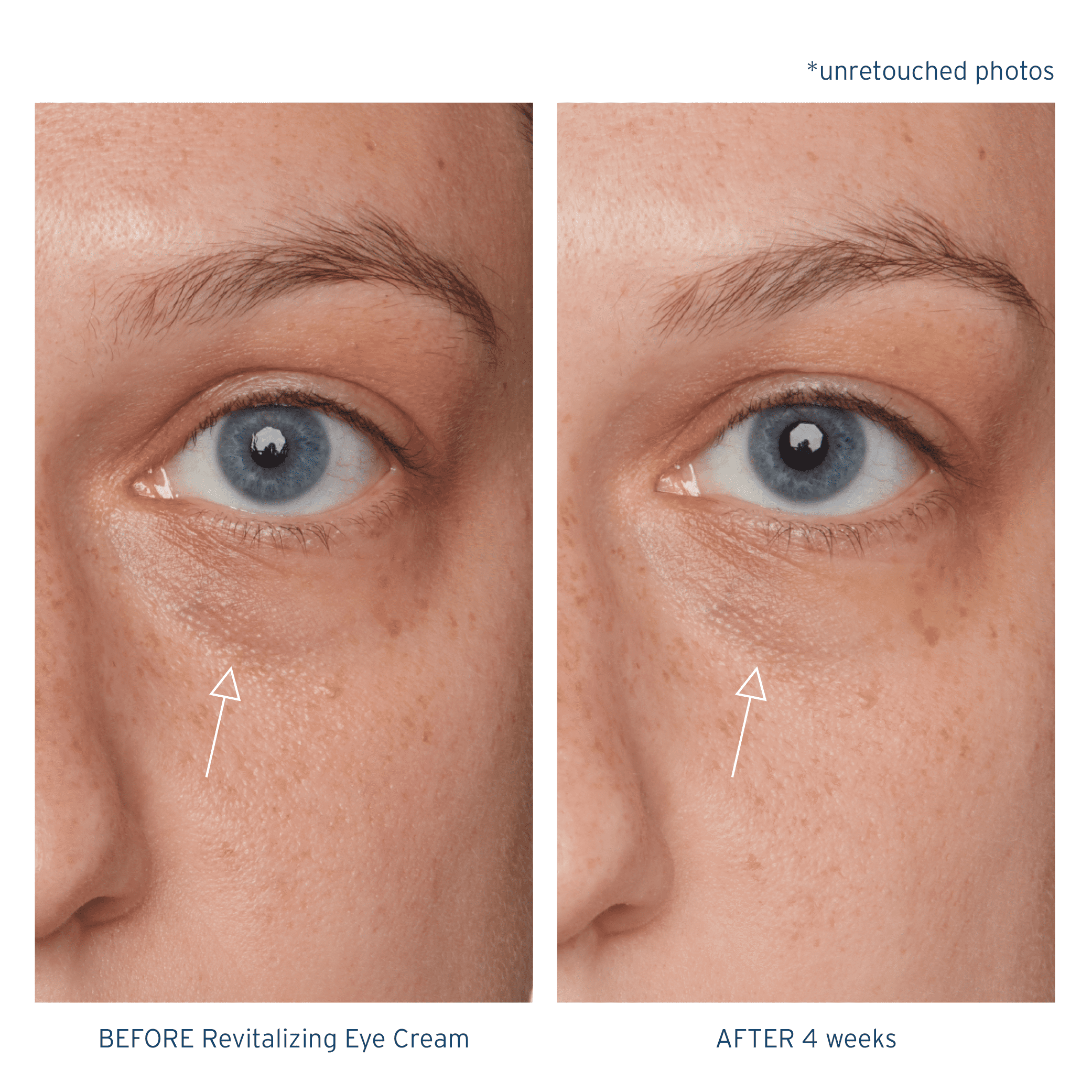 Santo Remedio, Piel Eterna, Revitalizing Eye Cream, Illuminating Eye Cream, Helps Reduce Dark Circles, Contains Marina Algae, Caffeine, Aloe, Hyaluronic Acid, Vitamin E, For All Skin Types, 1 Fl. Oz.