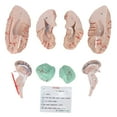 thumbnail image 3 of Modelo De Cerebro ANGGREK Modelo De Anatomía Cerebral Profesional Extraíble, 3 of 8