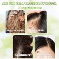 thumbnail image 6 of Tgideas Rosemary Biotin Amino Acid Shampoo – Volumizing & Nourishing Formula for Fuller-Looking Hair, Suitable for Men & Women, 8.45 fl oz, 2-Pack, 6 of 7