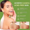 thumbnail image 2 of Antifungal Soap for Men and Women: Medicinal Antifungal Tea Tree Oil Bar Soap - Extra Strong Skin Fungus Treatment,Inguinal Tinnitus and Tinnitus, 2 of 5