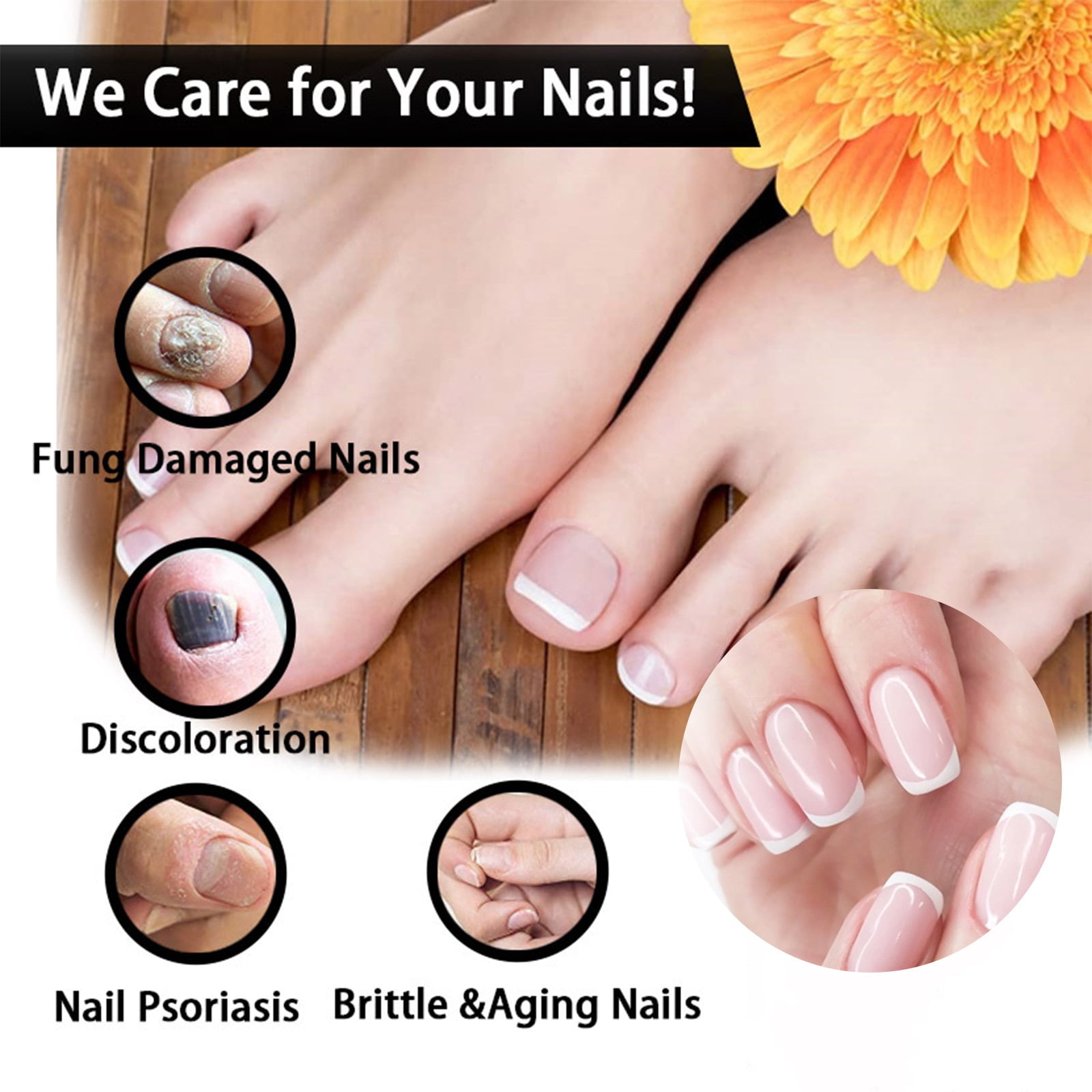 Alvantor Nail Fungus Treatment, Nail Repair Oil Moisturizing and Daily Care, 1fl.oz