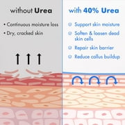Ebanel Urea Cream 40% plus Salicylic Acid 2%, Foot Cream for Dry Cracked Heels Feet Knees Elbows Hands, Foot Dead Skin Cuticle Callus Remover Toenail Softener, Keratolytic Skin Barrier Repair, 2-Pack
