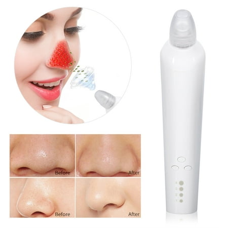 Electric LED Facial Pore Cleanser Face Blackhead Acne Removal Skin Cleaner Device, Blackhead Removing Cleaner, LED Pore
