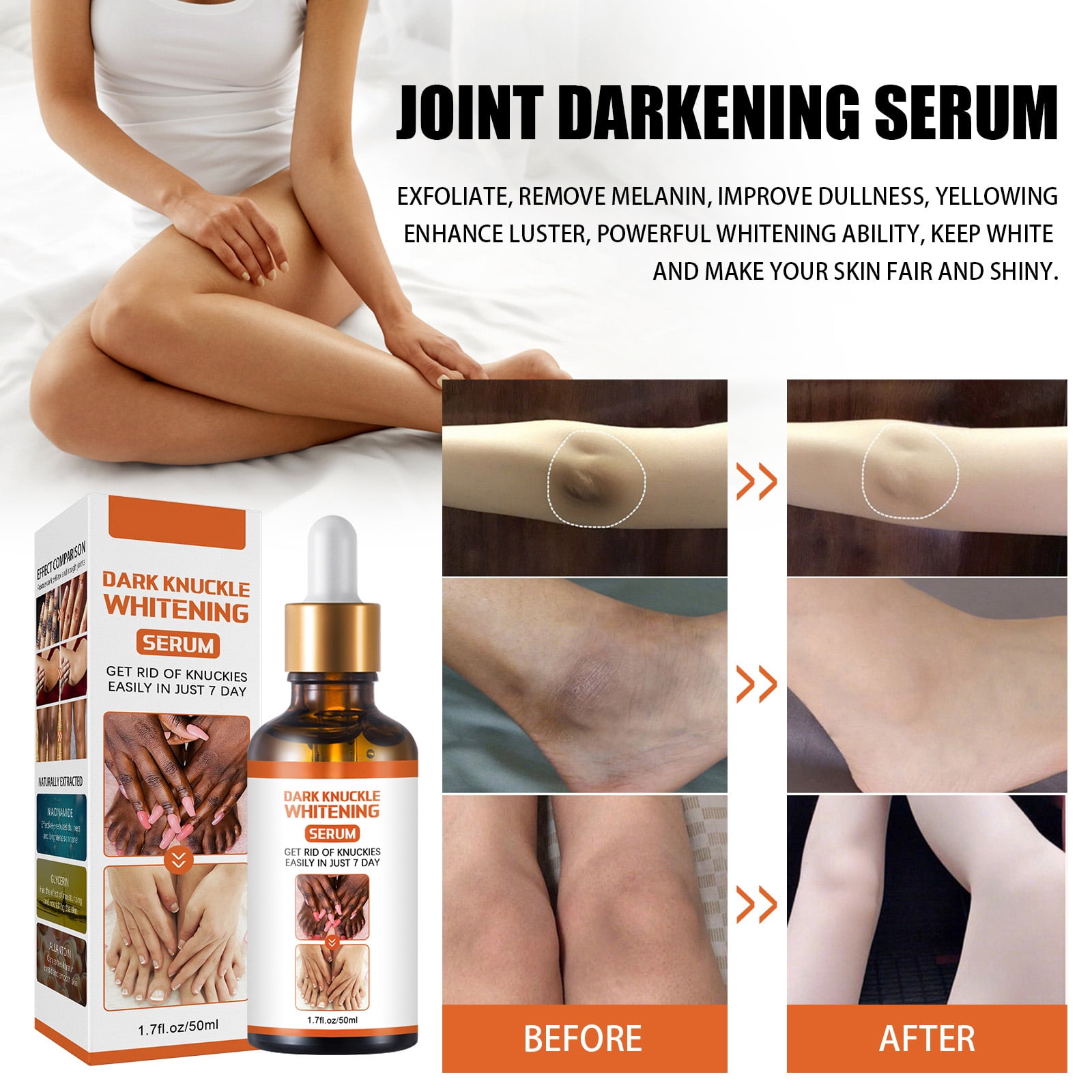 Alvantor Dark Spot Corrector for Hands & Body 1.7 fl oz Lightening Serum