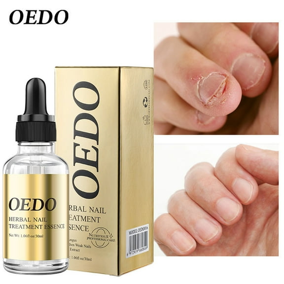 Lenkho Nail Fungus Liquid, Fungal Nail Polish for Toenails & Fingernails, Nail Treatment Oil, Supports Nail Growth, Restores the Natural Appearance of Nails, Gentle on Nails