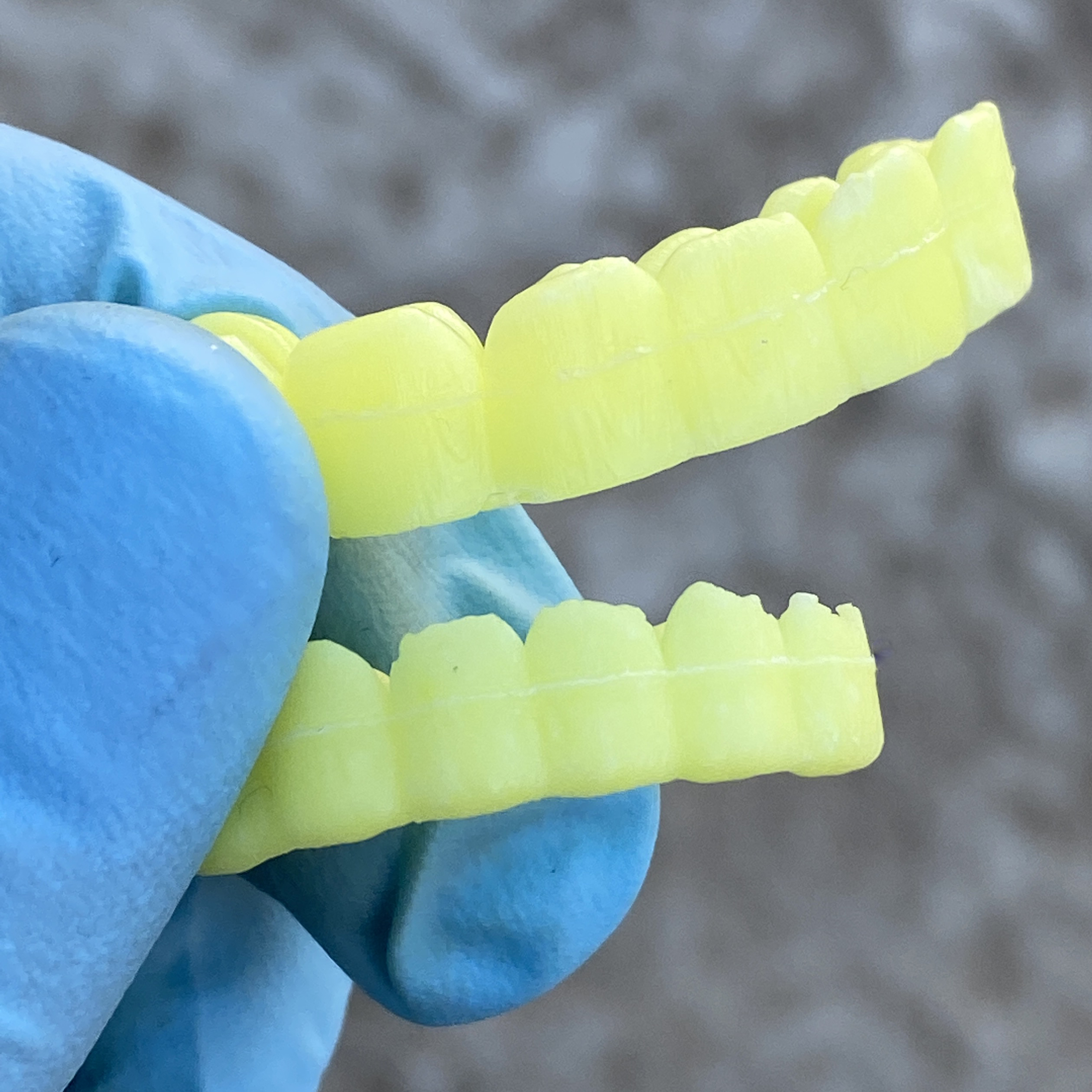 Buy Yellow Silicone Grillz Molding Bars Set For Top & Bottom Teeth