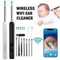 thumbnail image 4 of Visual Ear Pick Spoon Integrated Replacement-Free Ear Pick Tool Magnifying Luminous Ear Pick With Light Ear Pick Spoon, 4 of 7