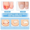 thumbnail image 2 of Kit de eliminación de uñas encarnadas con tiras para uñas encarnadas, parche corrector para uñas curvas, lima para uñas y herramientas para pedicura para mujer y hombre, 2 of 6