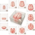 thumbnail image 1 of Anatomic Brain Specimen Coasters (Set of 10 pieces), 1 of 7