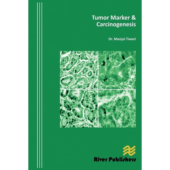 Tumor Marker & Carcinogenesis, (Paperback)