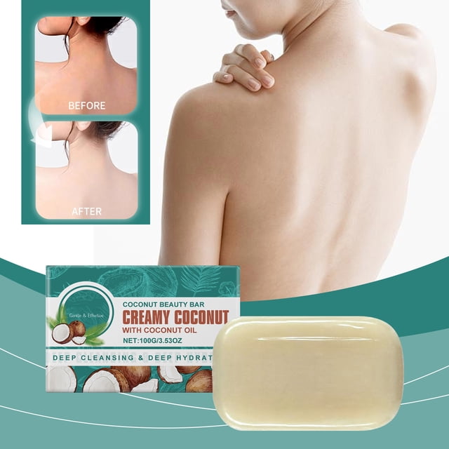 fiudx jabón de baño de coco, fórmula a base de aceite natural, limpieza suave, hidratación nutritiva, cuidado para piel grasa, uso diario, pastilla de jabón de 100 g — pastilla beige claro frontal junto a su empaque verde y blanco con texto y motivos de coco; fondo con espaldas de mujer mostrando piel limpia en vista 3/4; composición centrada que destaca tamaño y diseño, adecuada para uso diario y práctica para viaje.