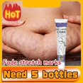 thumbnail image 2 of Crema para eliminar las marcas de estiramiento, Gel para el cuidado de la piel posparto del embarazo, color rojo y blanco antiguo, 2 of 5