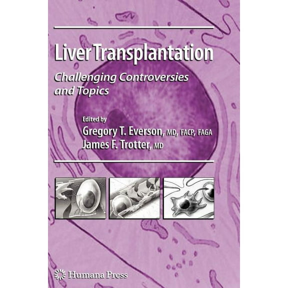 Clinical Gastroenterology Liver Transplantation: Challenging Controversies and Topics, (Paperback)