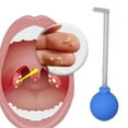 thumbnail image 1 of Tonsil Stone Remover Kit, Tonsil Stone Remover Vacuum Glass PVC  for Daily Use, 1 of 8
