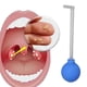 thumbnail image 1 of Aspiradora para quitar piedras de amígdalas tipo manual reduce el mal aliento kit para quitar piedras de amígdalas para uso diario Anggrek Otros, 1 of 8