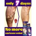 thumbnail image 2 of Pomada para venas varicosas, reparación de venas varicosas y vasculitis, 2 of 5