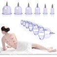 thumbnail image 1 of 12x Cupping Therapy Set, Chinese Medical Cupping Physiotherapy Set With Vacuum, 1 of 5