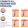 thumbnail image 5 of ExquisiteRazor Bumps Treatment for Women and Men, Shave Solution Roll-On for Face,Neck, Legs, and Underarm Area, Smooth Skin, 5 of 5