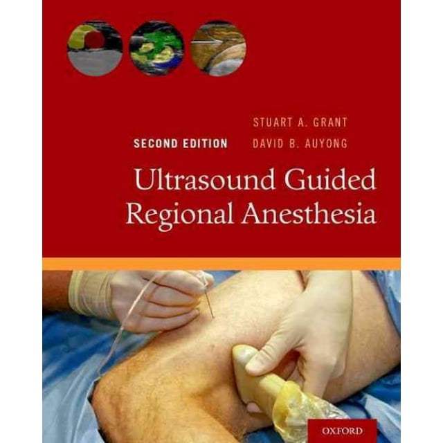 Ultrasound Guided Regional Anesthesia, Stuart A. Grant, David B. Auyong Paperbac