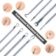 thumbnail image 4 of Kit De Herramientas Para Eliminar Espinillas, 4 Uds., Herramientas Para Eliminar Espinillas Y Espinillas Con Caja De Almacenamiento Advancent HA034927-00, 4 of 6