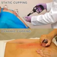 thumbnail image 3 of Cupping Therapy Massage Kit w Pump 12 Cups for Cellulite Muscle, 3 of 5