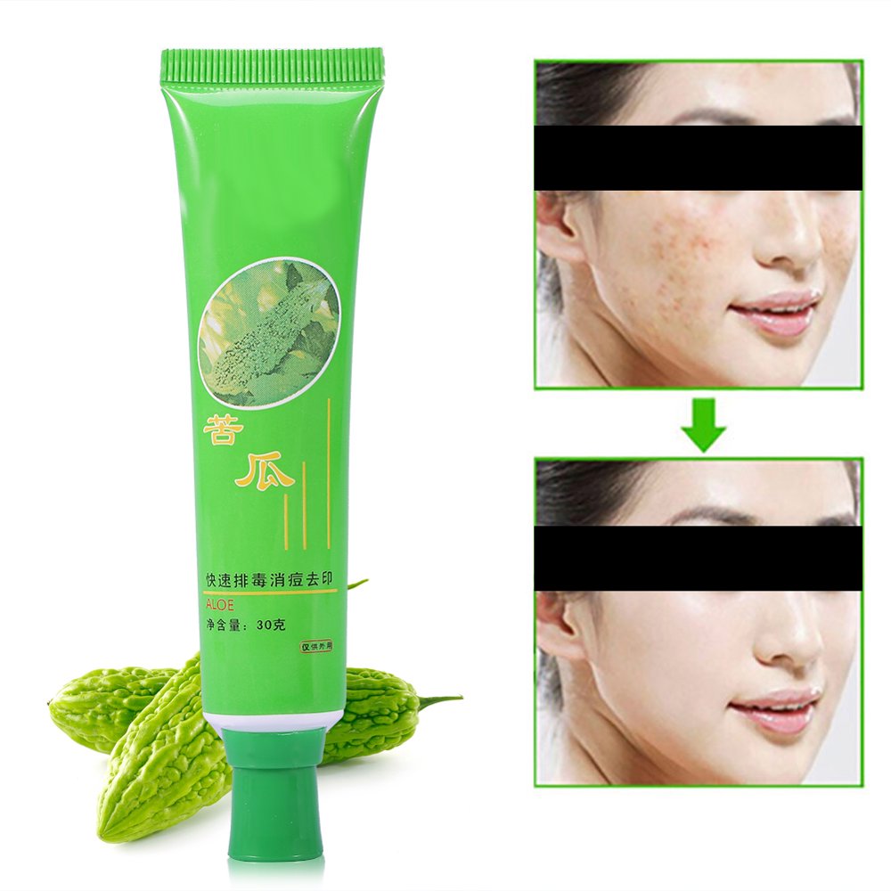 FAGINEY Face Acne Pores Cream Pimple Spots Blackhead Treatment Blemish