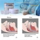 thumbnail image 2 of ANTI SNORING MOUTH GUARD Device Sleep Aide Adjustable Mouth-Free Buds, 2 of 5