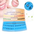 thumbnail image 1 of Brackets autoligantes dentales, 21 piezas Brackets autoligantes dentales de ortodoncia Sel F Bracket autoligante activo Valor inmejorable, 1 of 8