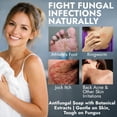 thumbnail image 4 of Antifungal Soap with Lemon Oil | Medicated Jock Itch Treatment Helps Fight Ringworm & Athlete’s Foot | Tolnaftate 1% Antifungal Cleansing Bars with Case | Infused with Sweet Orange & Grapefruit Oils, 4 of 6
