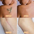 thumbnail image 5 of Breathable Tattoo and Flaw Concealing Tape Scars Flaw Cover UP Tape Stickers Flesh Colored Waterproof Tattoo Concealing Tape, 5 of 8