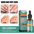thumbnail image 4 of Fungal Nail Treatment, Extra Strong Nail Fungus Treatment For Toenail, Nail Repair -30ml, 4 of 5