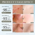 thumbnail image 4 of Fiudx Ofertas relámpago del día Mascarilla hidratante de colágeno Crystal Split Mask Jelly Color Disoluble Mask 25 ml 1ud, 4 of 7