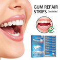 thumbnail image 3 of Jaysuing Teeth Strips Deep Cleaning Teeth Stain Teeth Yellow Tartar Whitening Teeth Care Gum Oral Care Stickers, 3 of 4