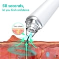 thumbnail image 4 of Removedor de espinillas con cámara, función de espinillas de microscopio 20X y instrumento de belleza de la piel con pantalla vinculada Wifi con 6 sondas reemplazables Adepaton 2035604, 4 of 9