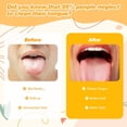 thumbnail image 5 of Raspador de lengua de acero inoxidable, limpiador de lengua, raspador de lengua portátil, fácil de usar para adultos y niños，Oro Sunnimix limpiador de lengua, 5 of 5