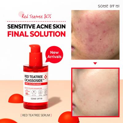 some by mi red teatree cicassoside derma solution serum