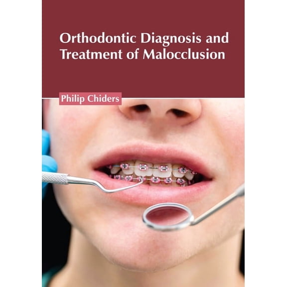 Orthodontic Diagnosis and Treatment of Malocclusion, (Hardcover)