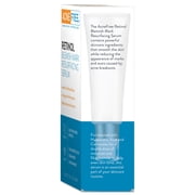 AcneFree Retinol Blemish Mark Resurfacing Serum, with Hyaluronic Acid & Ceramides, 1 fl oz