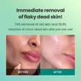thumbnail image 3 of Gel exfoliante Dr.G Brightening 120 ml, 3 of 7