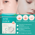 thumbnail image 3 of 72 Parches Invisibles Cubre Acne Espinillas Granos Facial, 3 of 7
