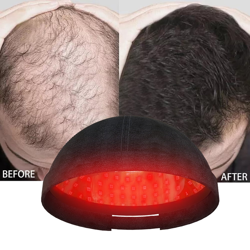 Yjt Laser Hair Growth Cap Hair Regrowth Helmet Hat for Men and Women