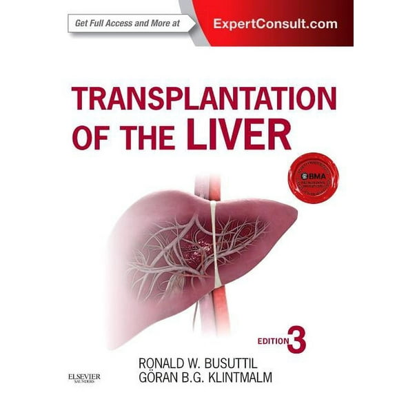 Transplantation of the Liver, (Hardcover)