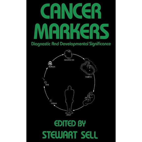 Contemporary Biomedicine Cancer Markers: Diagnostic and Developmental Significance, Book 1, (Hardcover)