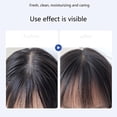 thumbnail image 3 of 300ml Selenium Disulfide Shampoo Smoothing Moisturize Anti-dandruff Itching, 3 of 5