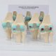 thumbnail image 5 of Knee Kit Osteoarthritis Anatomy Model with Educational Key Card 4 Stage Knee Model Orthopedic Teaching Aids, 5 of 5