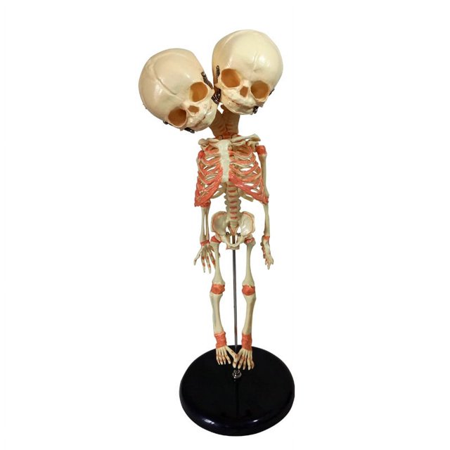 Anatomía del bebé de doble cabeza, esqueleto del cráneo, modelo médico anatómico de la educación de la anatomía del cerebro brillar Electrónica