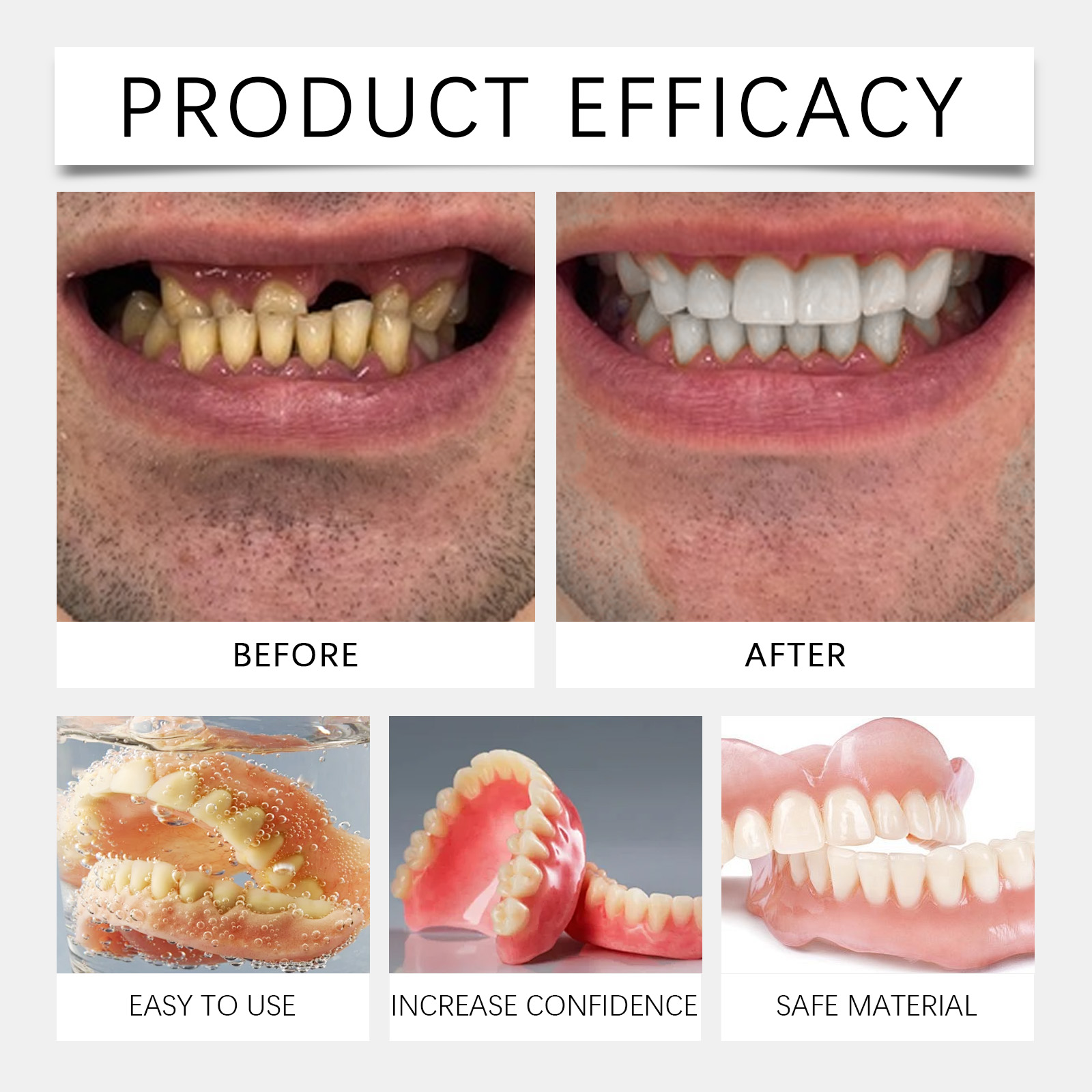 Alvantor Teeth Modification Kit Resin Teeth Cover Natural Fit Smile Enhancement