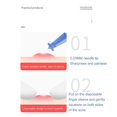 thumbnail image 4 of 50/100pcs Blackhead Blemish Remover Tool, Professional Disposable Acne Removal Needle, Whitehead Remover, Pimple Extractor Tool, 4 of 5