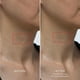 thumbnail image 5 of Mascarilla de hidrogel Karuna Skin COLLAGEN para escote y cuello, 4 paquetes, 5 of 9